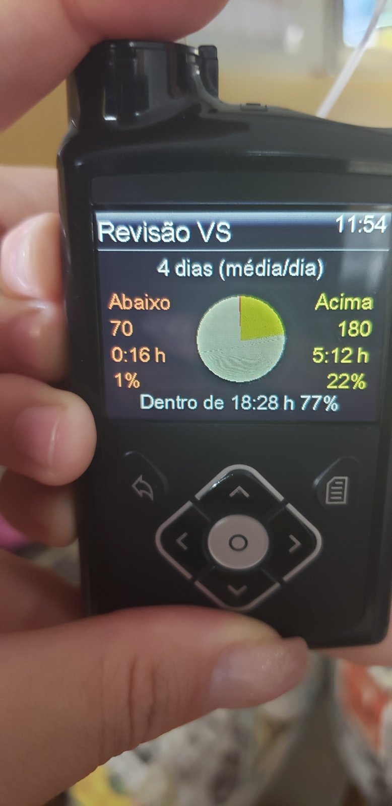 Tela da bomba de insulina mostrando a revisão de 4 dias: 77% do tempo entre 70 e 180 mg/dL, 1% abaixo e 22% acima